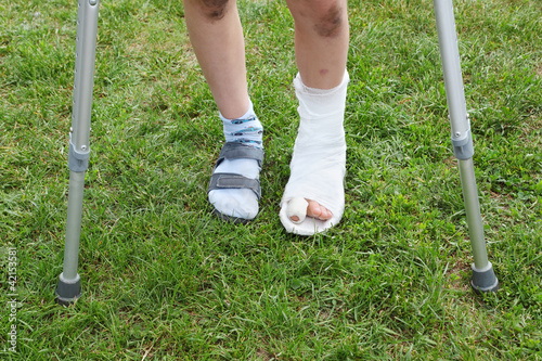 Legs of little boy on crutches; left leg in cast; photo