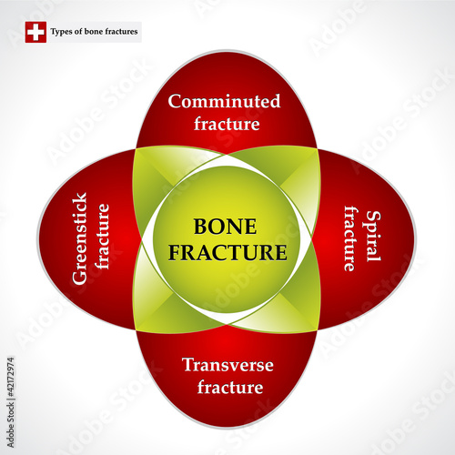 Types of bone fractures. Colorful chart