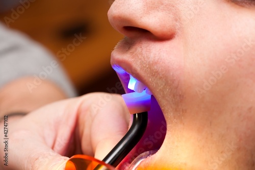Dental light
