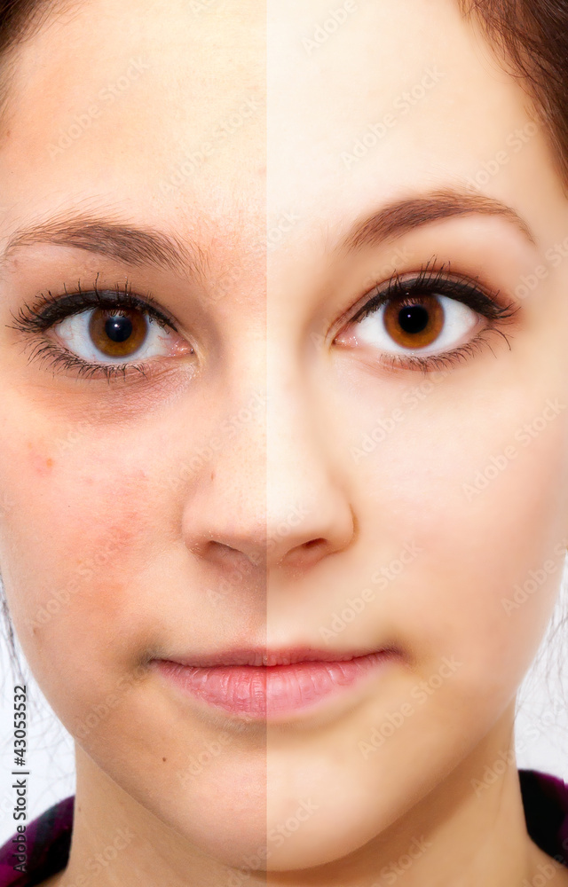 Beauty face - before and after Stock Photo | Adobe Stock