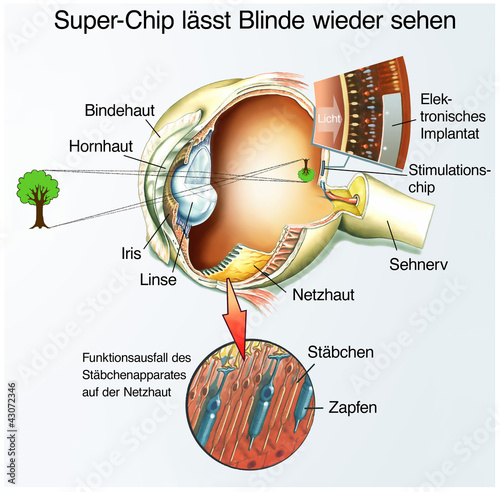 Spezial-Chip für Blinde photo