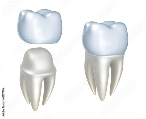 Dental crowns and tooth, isolated on white