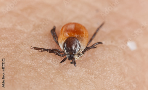 Tick on human skin. Extreme close-up with high magnification