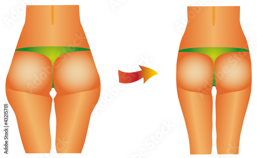 Diet beauty before after female buttocks