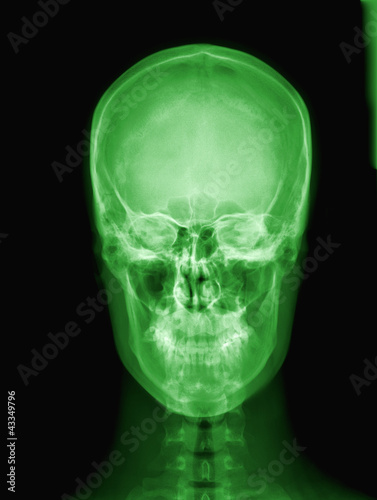 X-ray of Alien's skull.