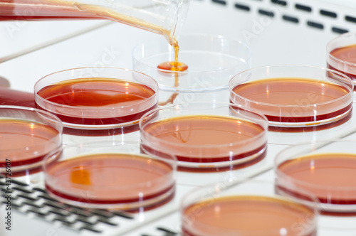 Placas de cultivo de bacterias rojas photo