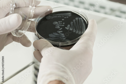 Manos de científico con placas de bacterias legionella negra photo