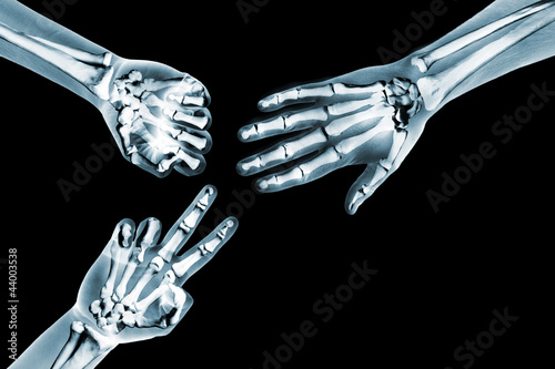 Foto rock paper scissors game with x ray hands