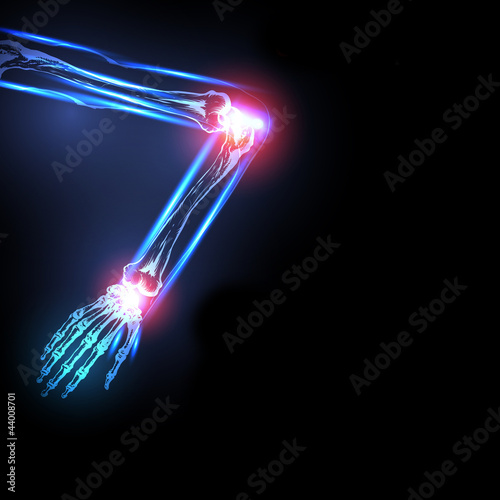 painful elbow illustration