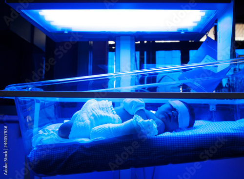 Baby Under Ultraviolet Light photo