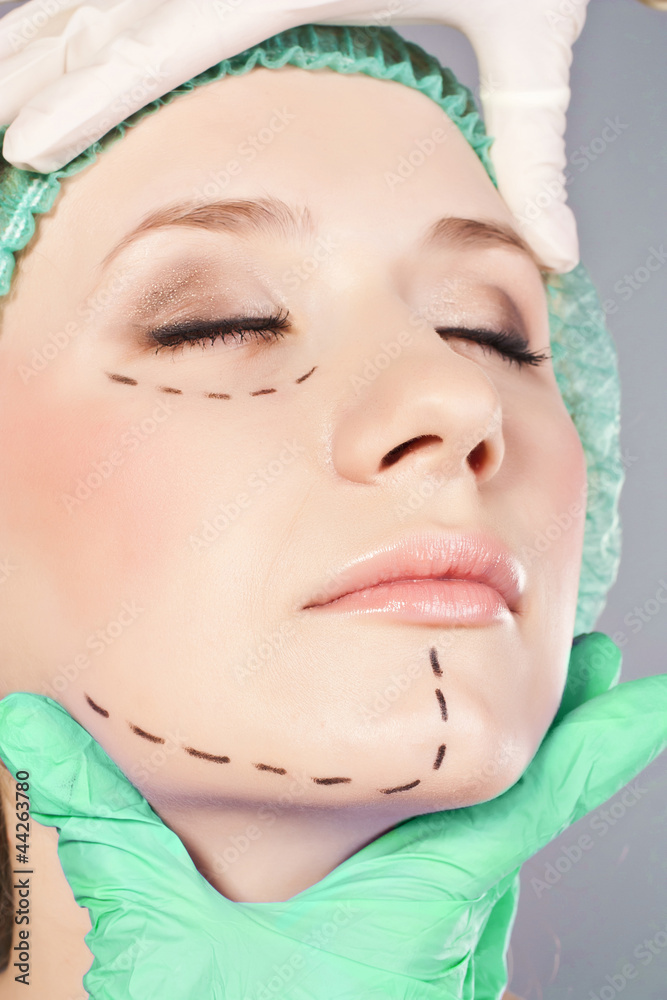 Lines on lady face, as marks for cosmetic plastic surgery Lines on lady face, as marks for cosmetic plastic surgery