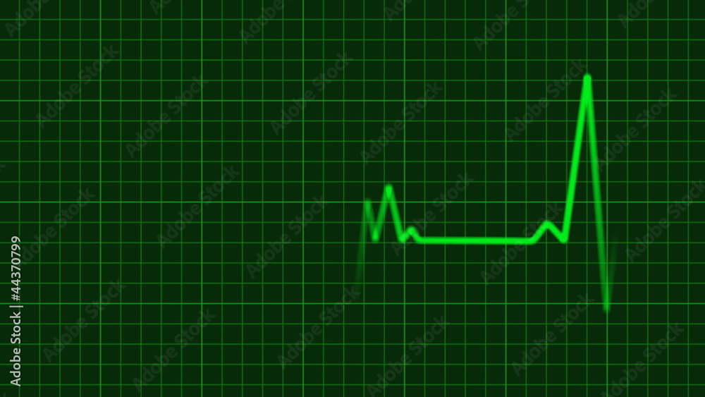 EKG Animation with Background EKG Animation with Background