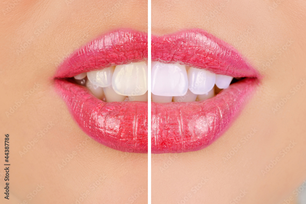 Naklejka premium whitening