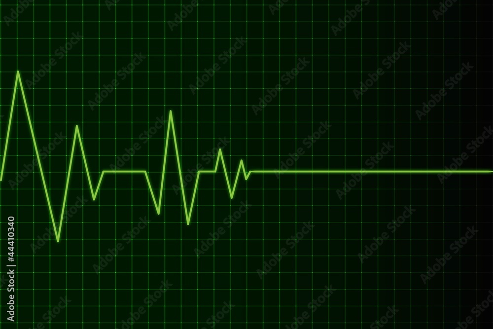 Naklejka premium elettrocardio