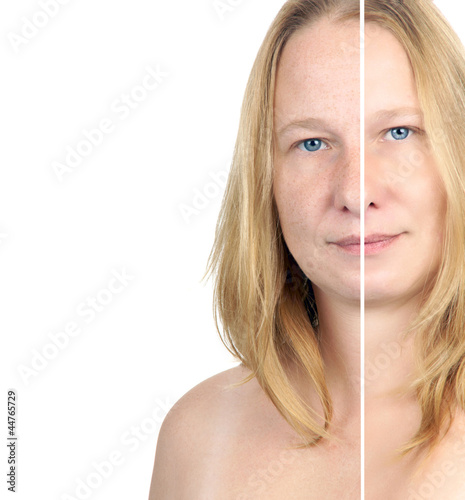 before / after image of a woman