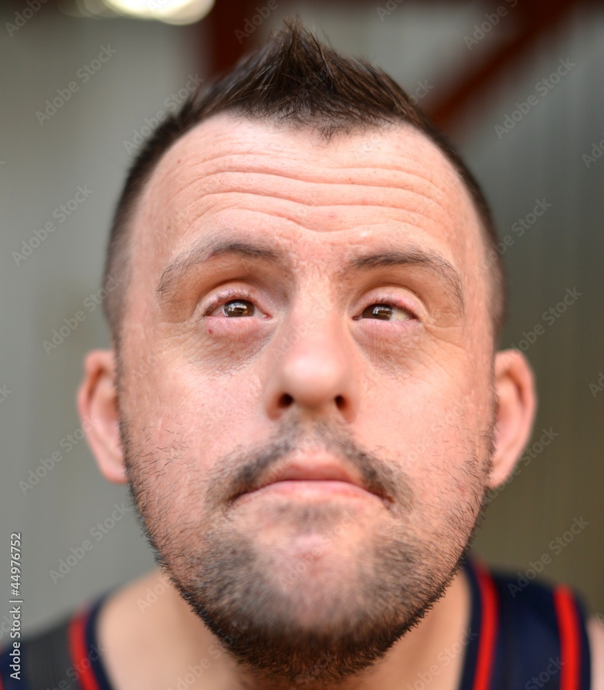 Obraz premium homme trisomique