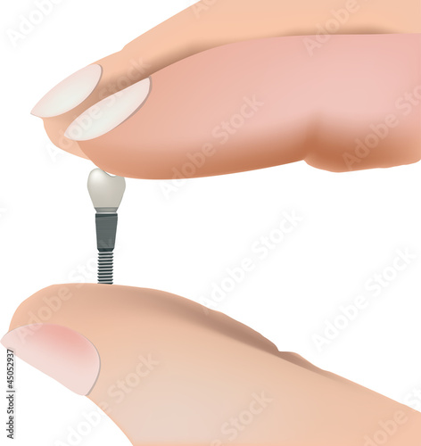 dental prosthesis