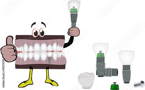 dental prosthesis