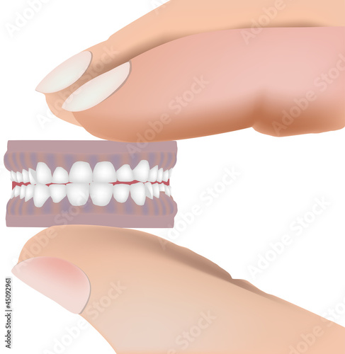 dental prosthesis