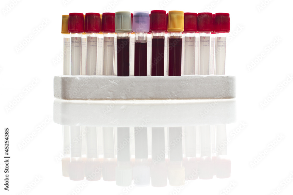 Sample tube