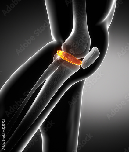 Canvas Print Meniscus lateral view