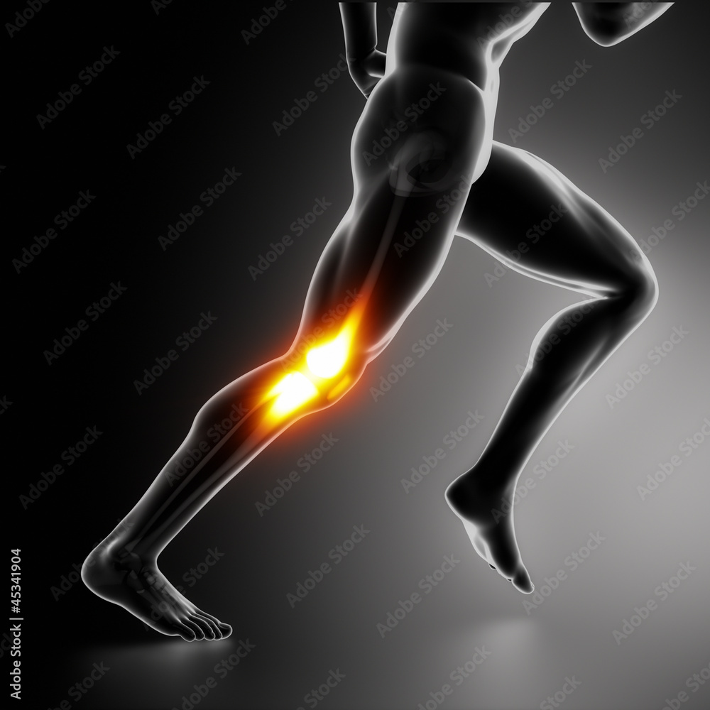 Sports Knee pain concept Sports Knee pain concept