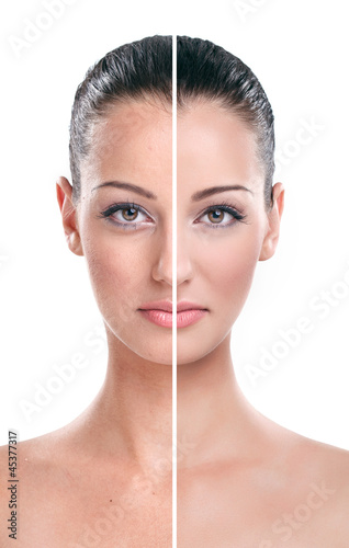Before and after - skin