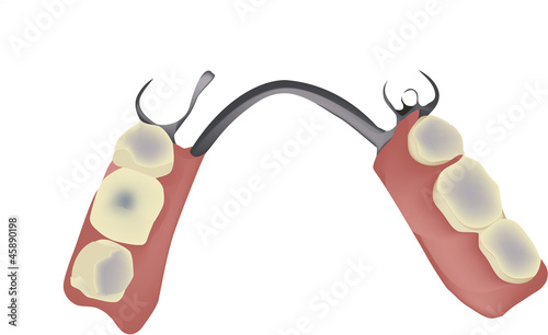 dentiera