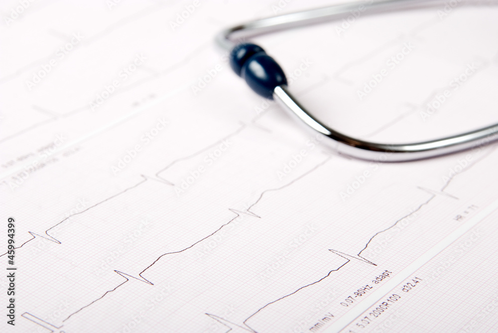 Stethoscope on ECG chart (electrocardiogram) Stethoscope on ECG chart (electrocardiogram)
