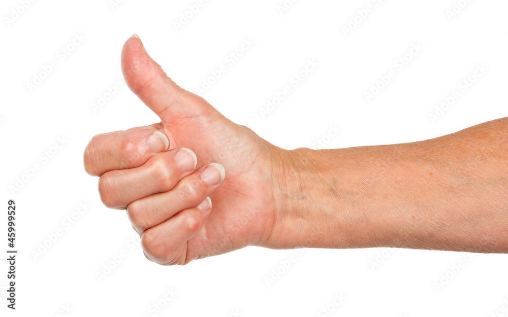 Old woman with arthritis giving the thumbs up sign Old woman with arthritis giving the thumbs up sign
