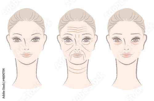 Beautiful woman getting wrinkles, under-eye bags as she ages
