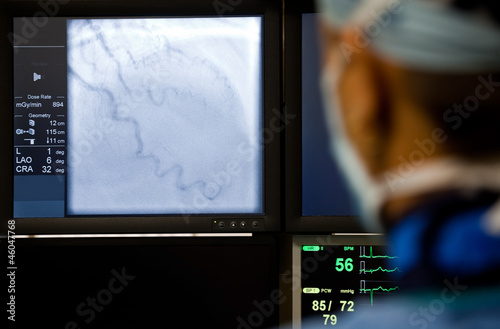 Doctor observing angiography machine photo