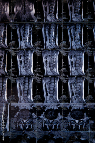 MRI real scan