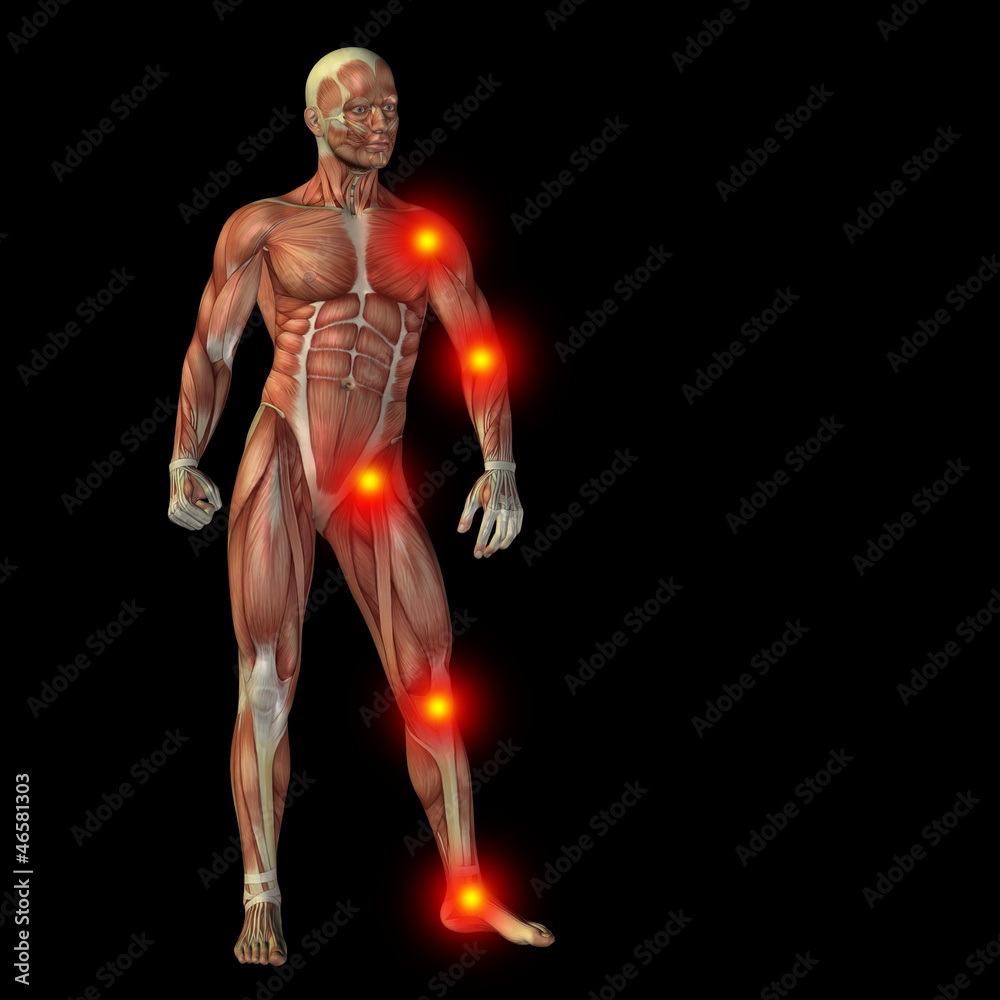 High resolution conceptual 3D human with inflammation