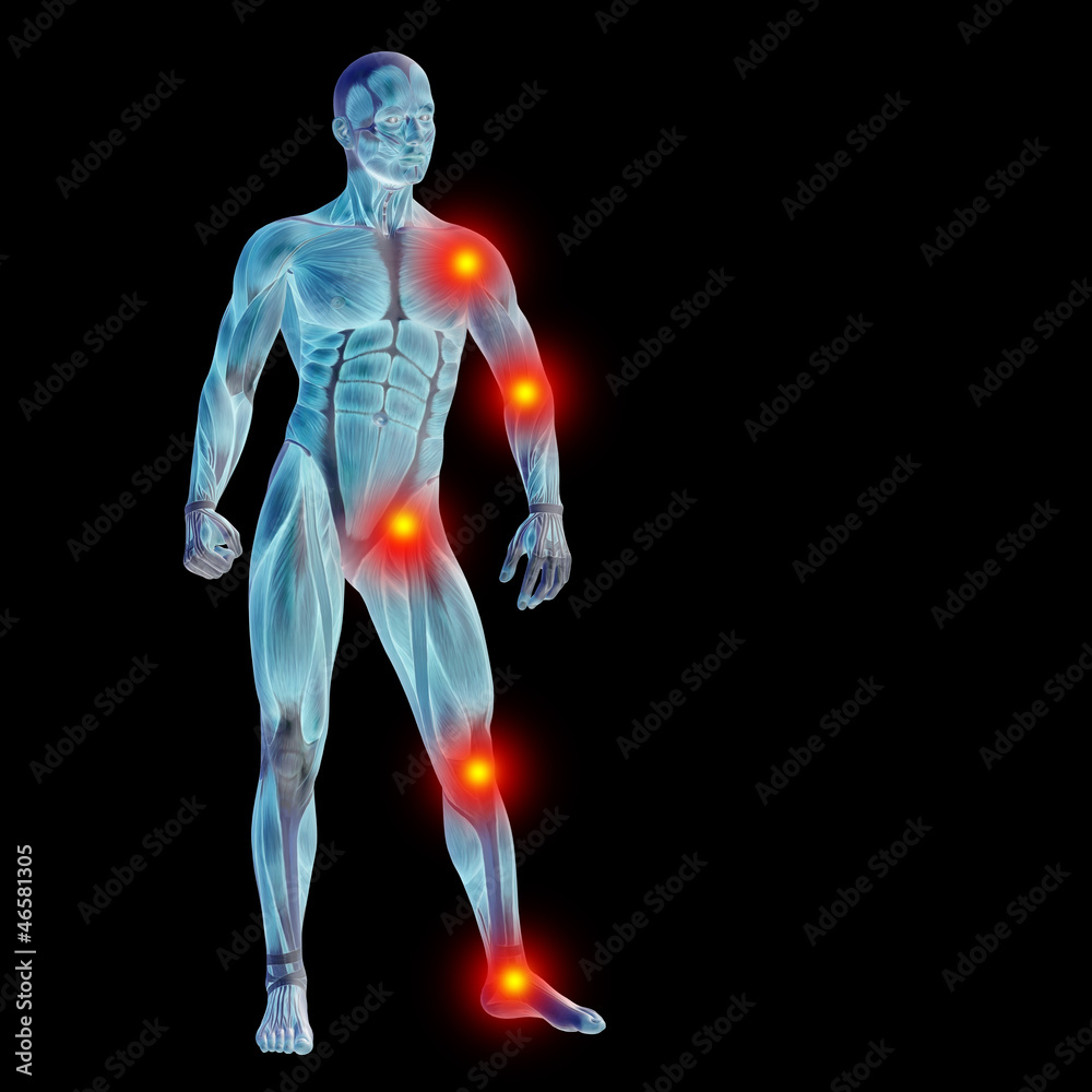 High resolution conceptual 3D human with inflammation High resolution conceptual 3D human with inflammation