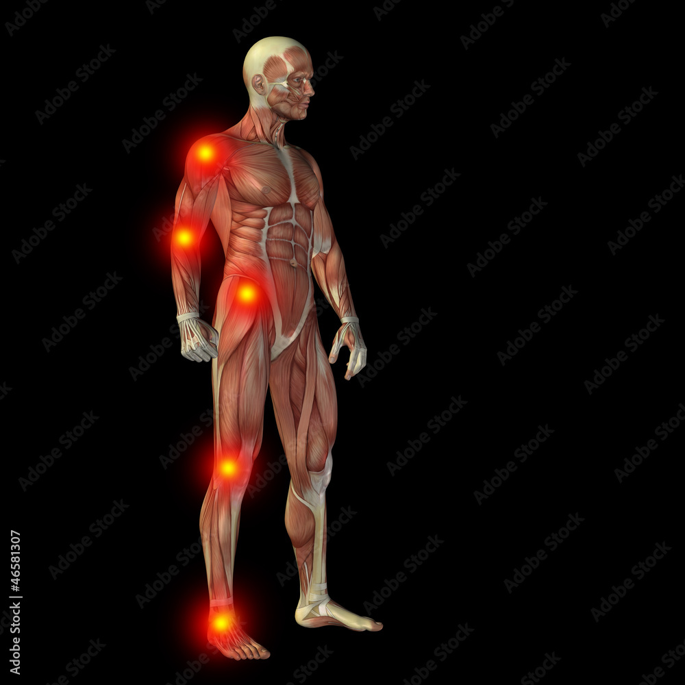 High resolution conceptual 3D human with inflammation High resolution conceptual 3D human with inflammation