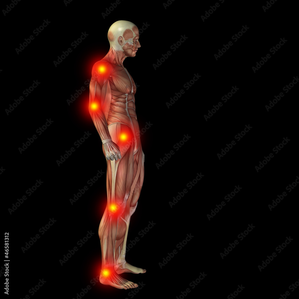 High resolution conceptual 3D human with inflammation High resolution conceptual 3D human with inflammation