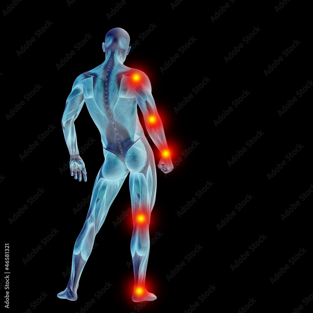 High resolution conceptual 3D human with inflammation