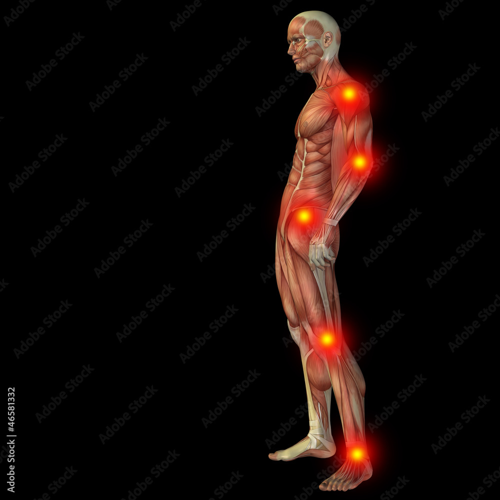 High resolution conceptual 3D human with inflammation High resolution conceptual 3D human with inflammation