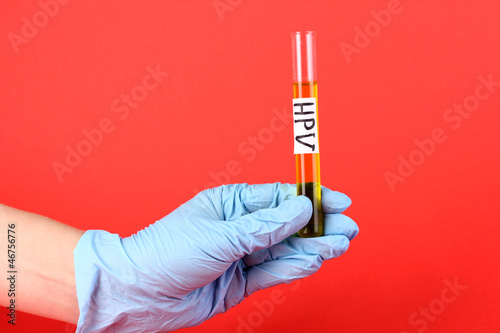 Test tube labeled Human