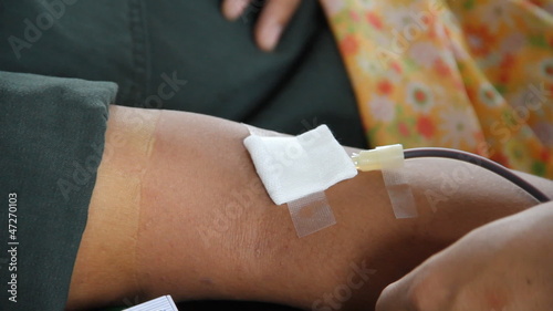arm of a donor donating blood 