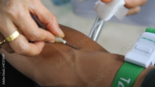 arm of a donor donating blood 