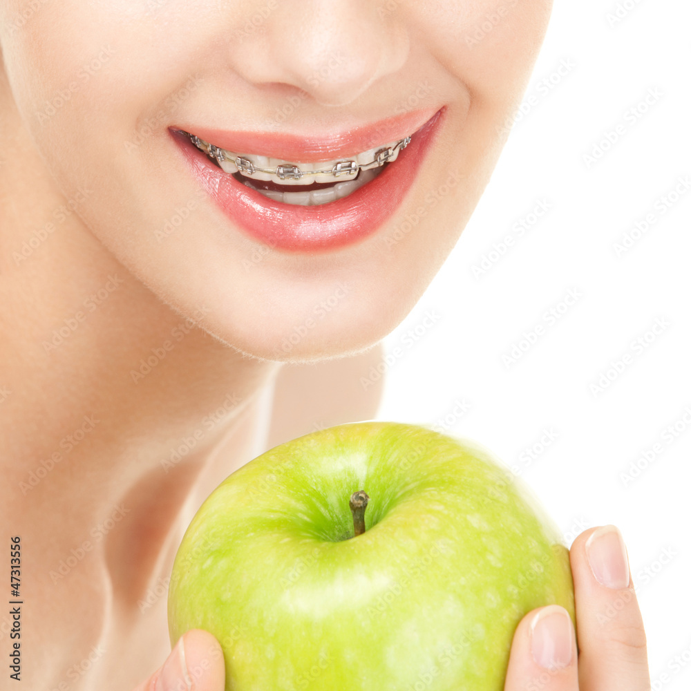 Girl in braces with green apple on white background Girl in braces with green apple on white background