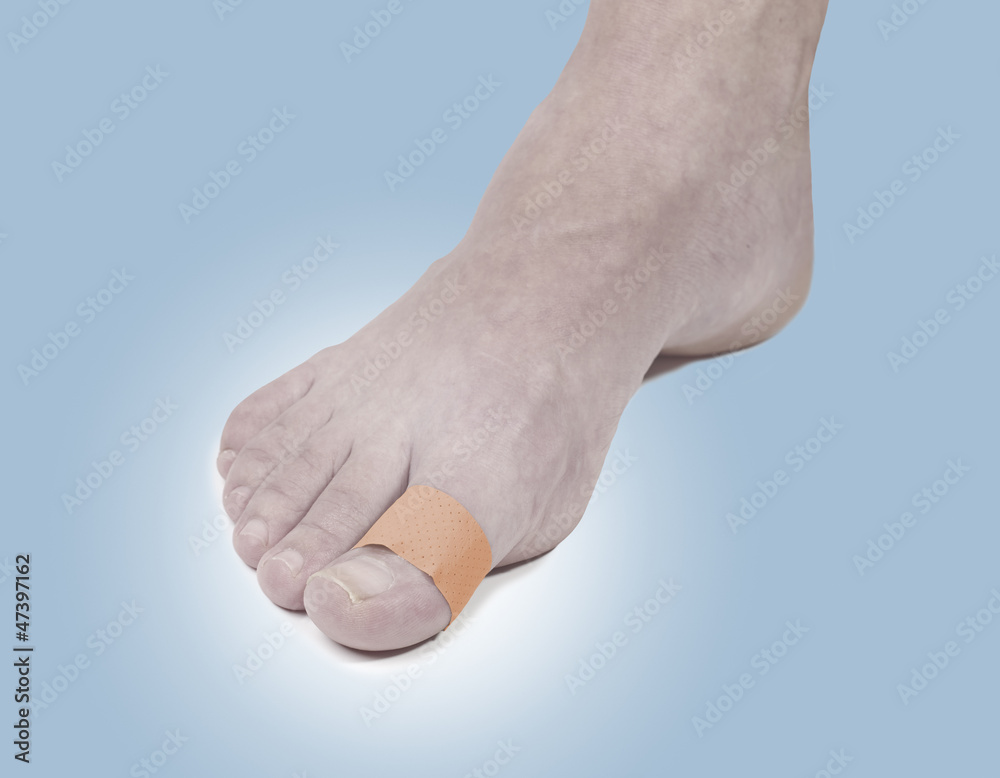 Adhesive Healing plaster on foot finger. Adhesive Healing plaster on foot finger.