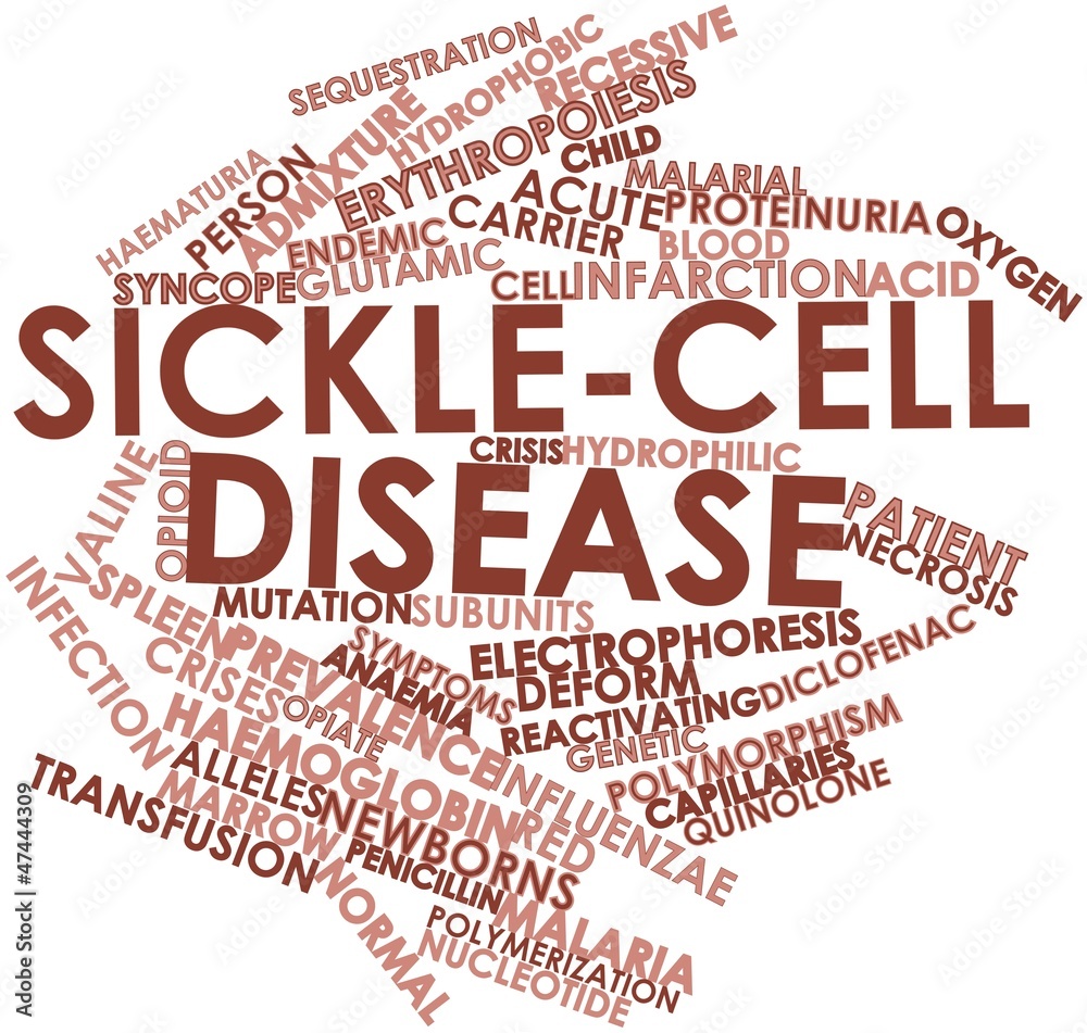 Word cloud for Sickle-cell disease Word cloud for Sickle-cell disease
