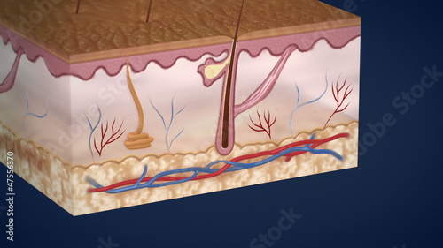 Layers of human skin and acne formation photo