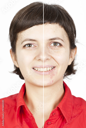 Face of young woman before and after skin healing.