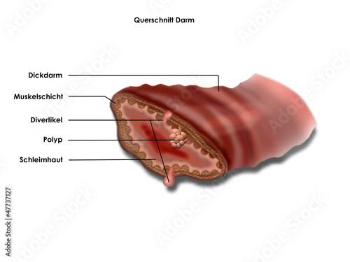 Foto querschnitt darm