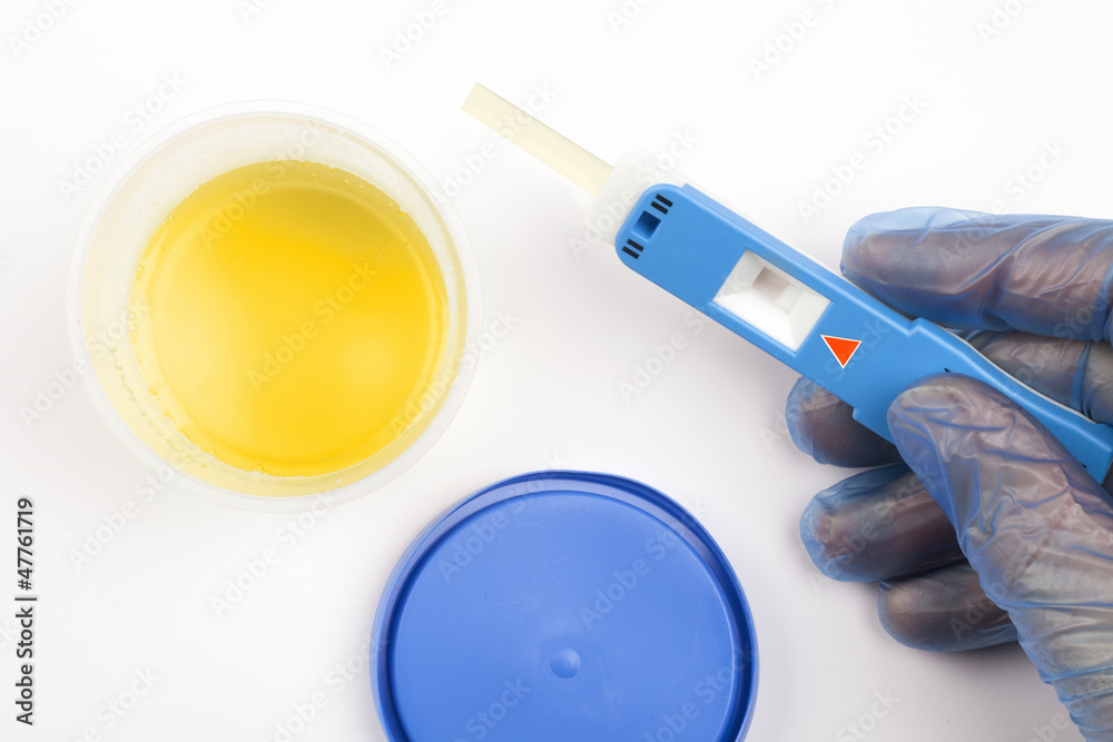 Urinprobe StockFoto Adobe Stock