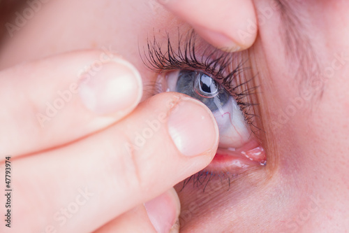 Close up of inserting a contact lens